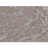 Immunohistochemistry - Anti-alpha cardiac muscle Actin Antibody (V0003) - Antibodies.com