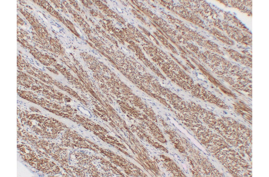 Immunohistochemistry - Anti-alpha cardiac muscle Actin Antibody (V0003) - Antibodies.com