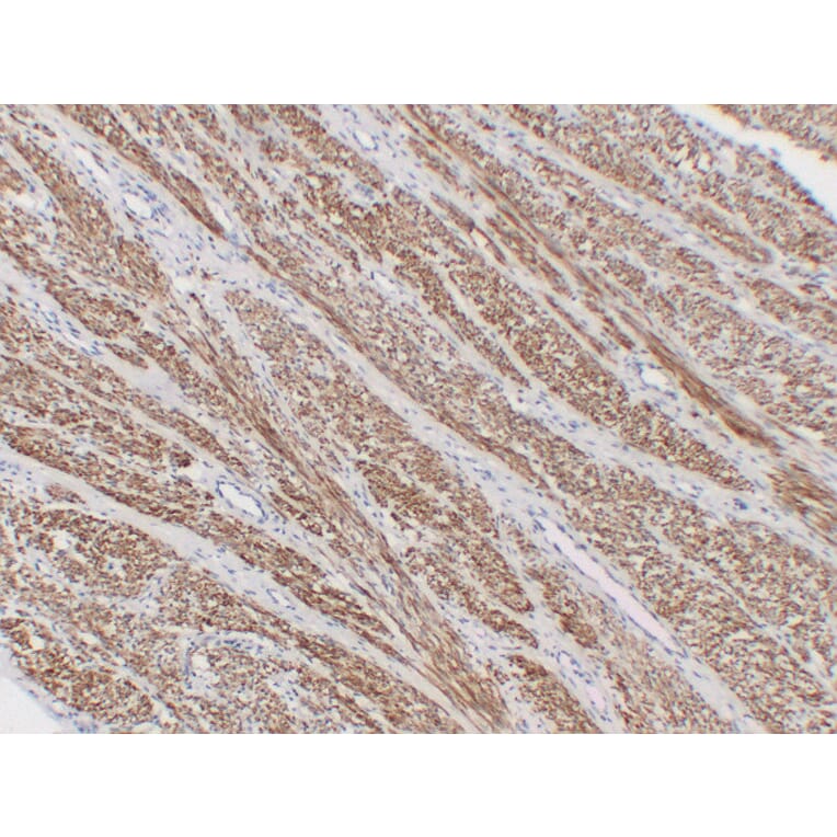 Immunohistochemistry - Anti-alpha cardiac muscle Actin Antibody (V0003) - Antibodies.com