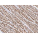 Immunohistochemistry - Anti-alpha cardiac muscle Actin Antibody (V0003) - Antibodies.com
