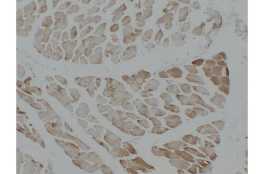 Immunohistochemistry - Anti-alpha cardiac muscle Actin Antibody (V0003) - Antibodies.com