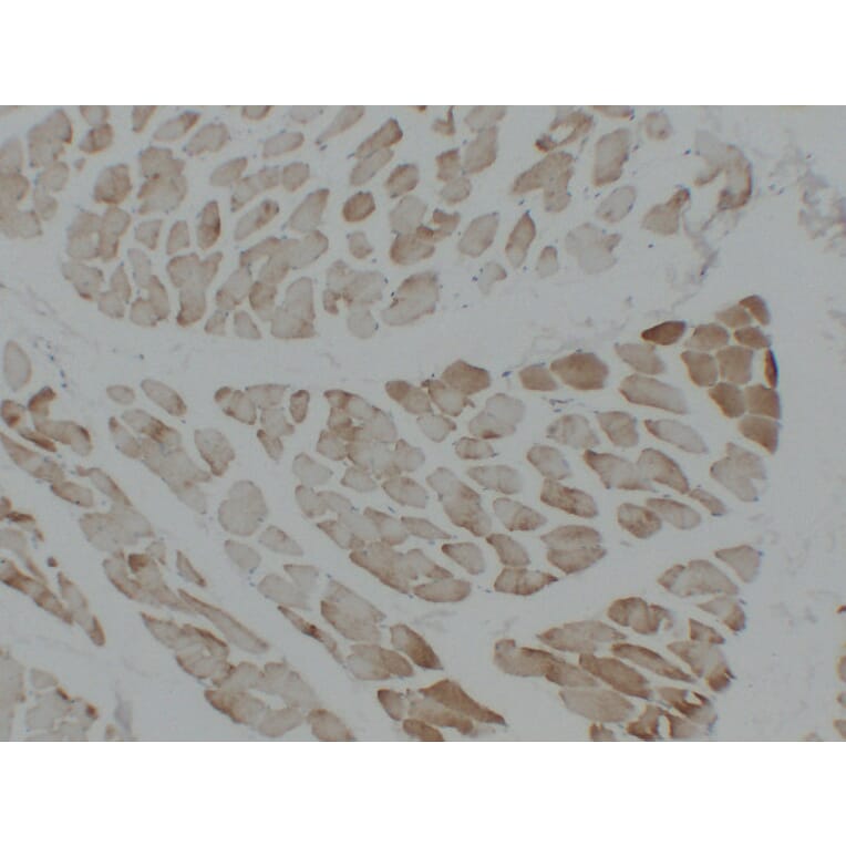 Immunohistochemistry - Anti-alpha cardiac muscle Actin Antibody (V0003) - Antibodies.com