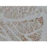 Immunohistochemistry - Anti-alpha cardiac muscle Actin Antibody (V0003) - Antibodies.com