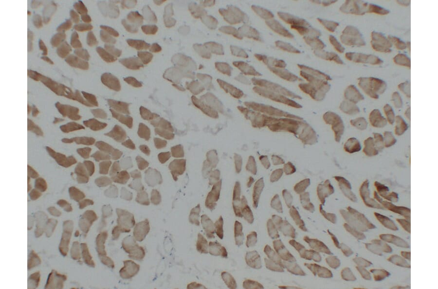 Immunohistochemistry - Anti-alpha cardiac muscle Actin Antibody (V0003) - Antibodies.com