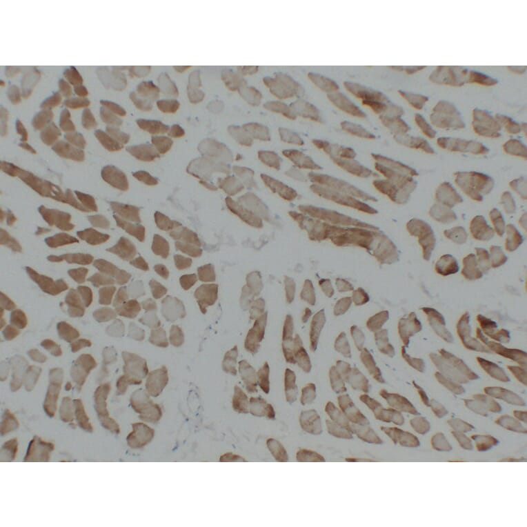 Immunohistochemistry - Anti-alpha cardiac muscle Actin Antibody (V0003) - Antibodies.com