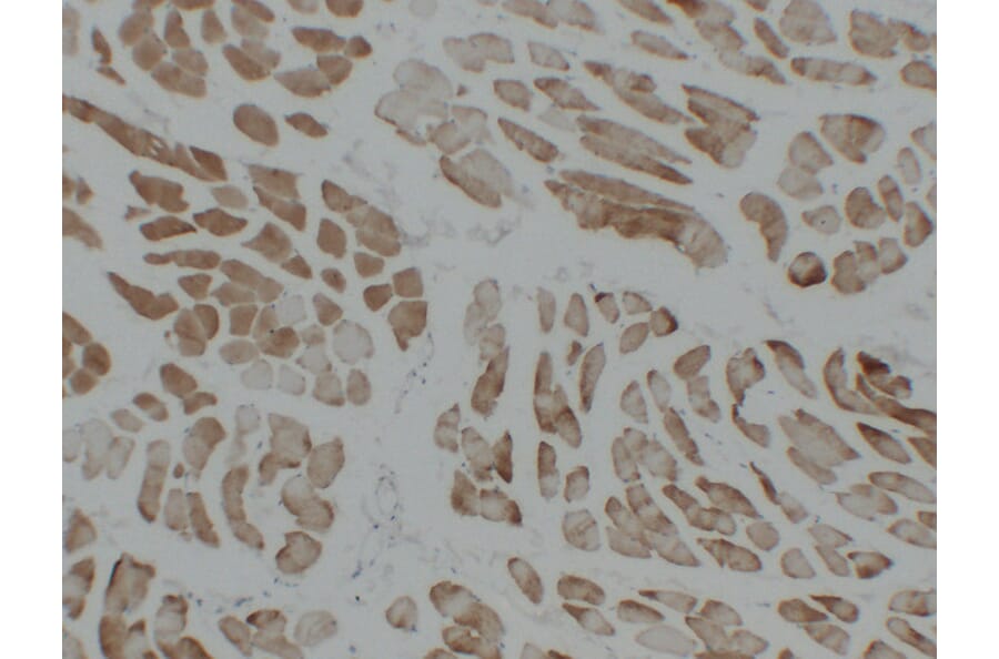 Immunohistochemistry - Anti-alpha cardiac muscle Actin Antibody (V0003) - Antibodies.com