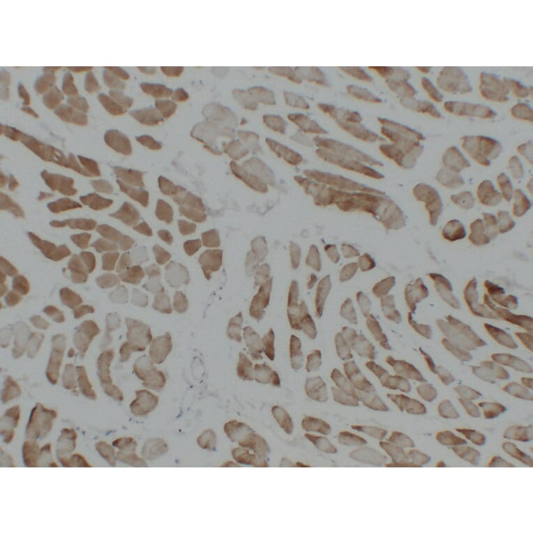 Immunohistochemistry - Anti-alpha cardiac muscle Actin Antibody (V0003) - Antibodies.com