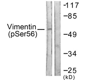Western Blot - Anti-Vimentin (phospho Ser56) Antibody (A1243) - Antibodies.com