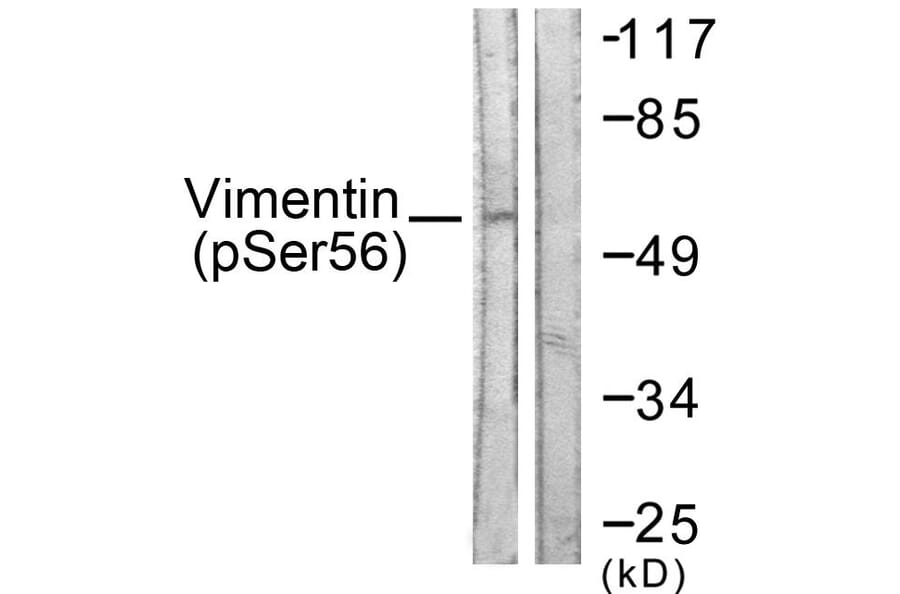 Western Blot - Anti-Vimentin (phospho Ser56) Antibody (A1243) - Antibodies.com