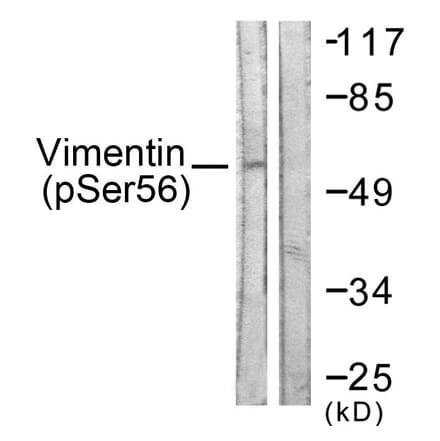 Western Blot - Anti-Vimentin (phospho Ser56) Antibody (A1243) - Antibodies.com