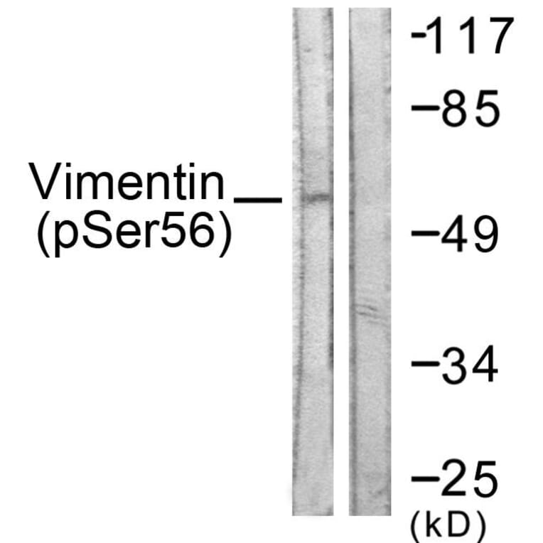Western Blot - Anti-Vimentin (phospho Ser56) Antibody (A1243) - Antibodies.com