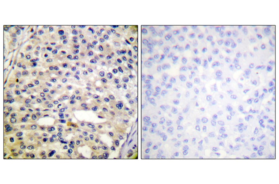 Immunohistochemistry - Anti-Vimentin (phospho Ser56) Antibody (A1243) - Antibodies.com
