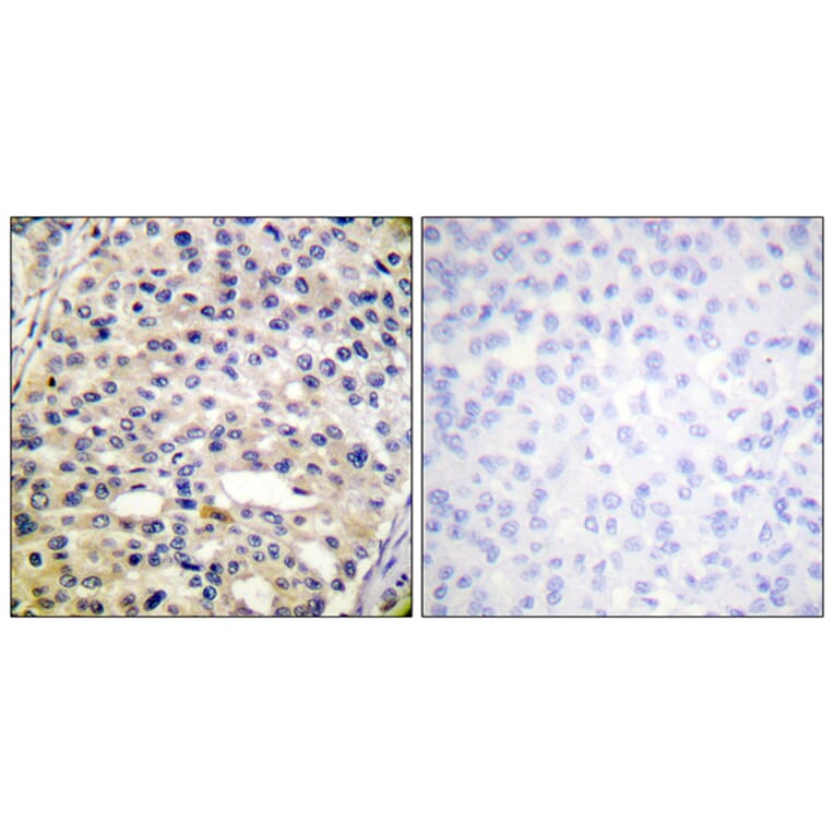 Immunohistochemistry - Anti-Vimentin (phospho Ser56) Antibody (A1243) - Antibodies.com