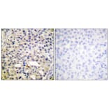 Immunohistochemistry - Anti-Vimentin (phospho Ser56) Antibody (A1243) - Antibodies.com