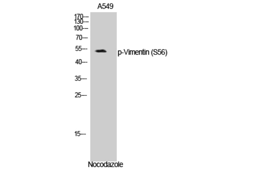 Western Blot - Anti-Vimentin (phospho Ser56) Antibody (A1243) - Antibodies.com