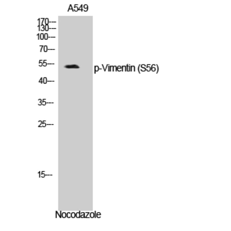 Western Blot - Anti-Vimentin (phospho Ser56) Antibody (A1243) - Antibodies.com