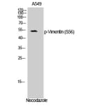 Western Blot - Anti-Vimentin (phospho Ser56) Antibody (A1243) - Antibodies.com