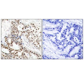 Immunohistochemistry - Anti-BRCA1 (phospho Ser1423) Antibody (A7030) - Antibodies.com