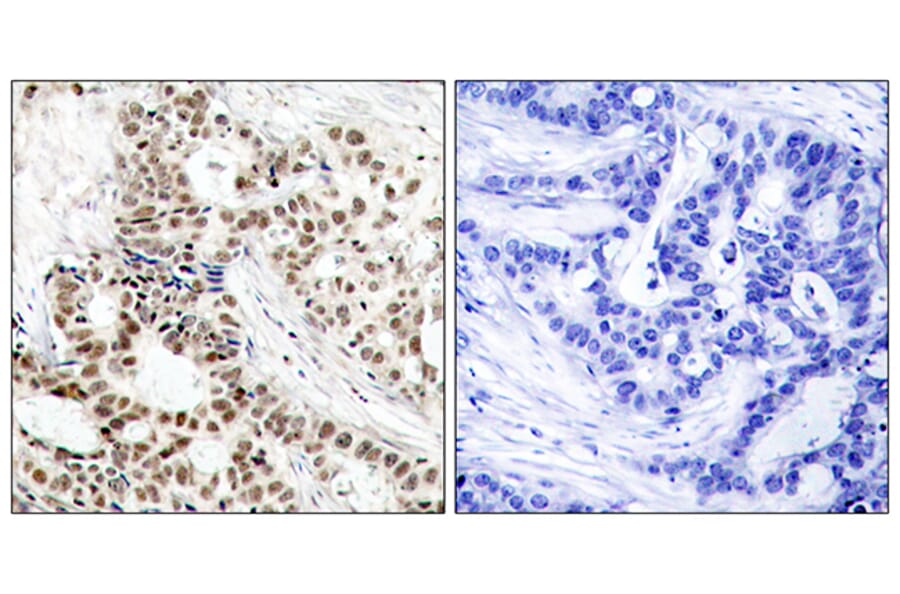 Immunohistochemistry - Anti-BRCA1 (phospho Ser1423) Antibody (A7030) - Antibodies.com