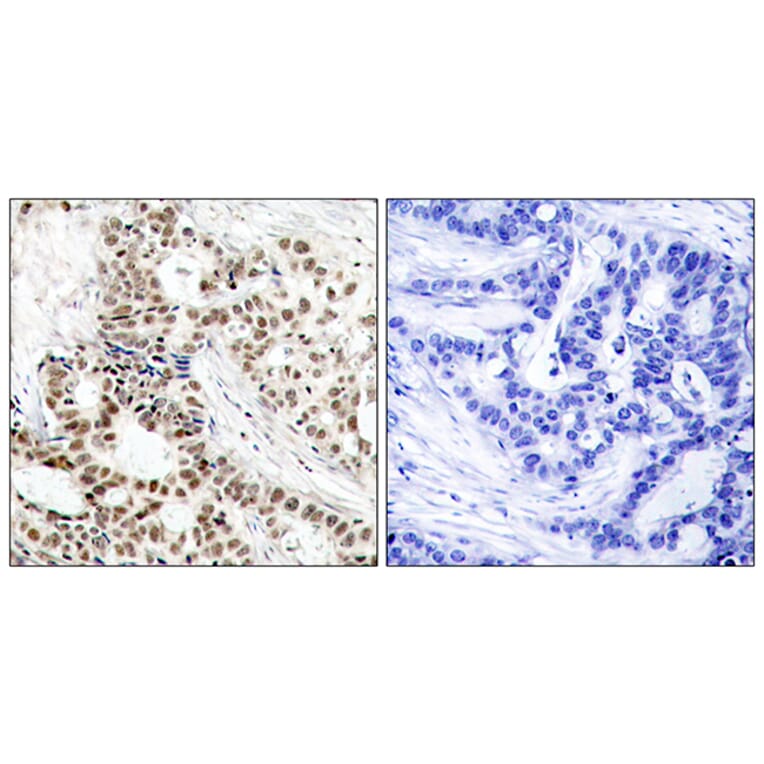 Immunohistochemistry - Anti-BRCA1 (phospho Ser1423) Antibody (A7030) - Antibodies.com