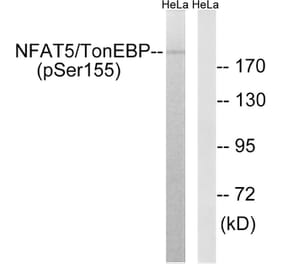 Western Blot - Anti-NFAT5 (phospho Ser155) Antibody (A8386) - Antibodies.com