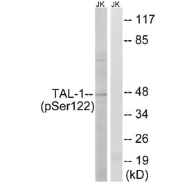Western Blot - Anti-TAL-1 (phospho Ser122) Antibody (A8431) - Antibodies.com