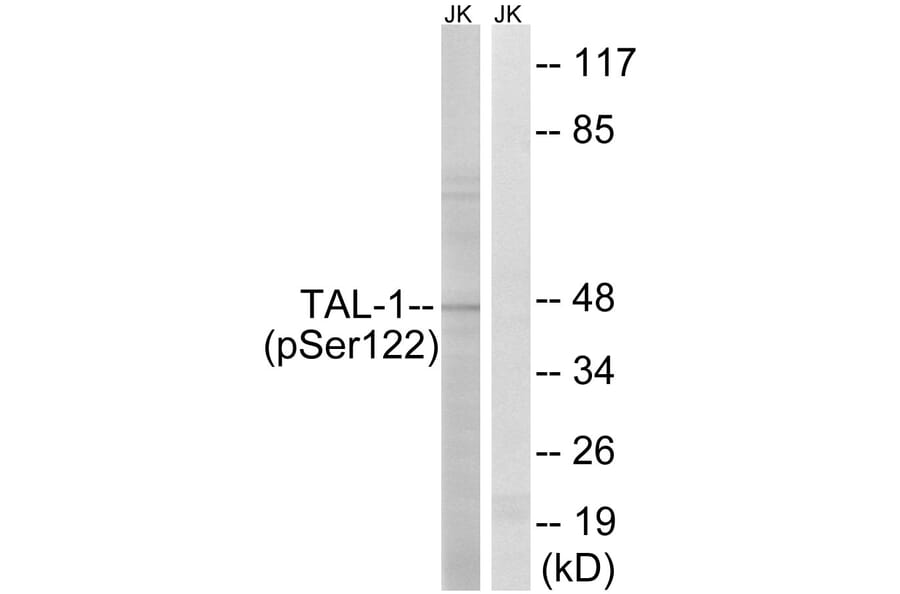 Western Blot - Anti-TAL-1 (phospho Ser122) Antibody (A8431) - Antibodies.com