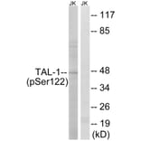 Western Blot - Anti-TAL-1 (phospho Ser122) Antibody (A8431) - Antibodies.com