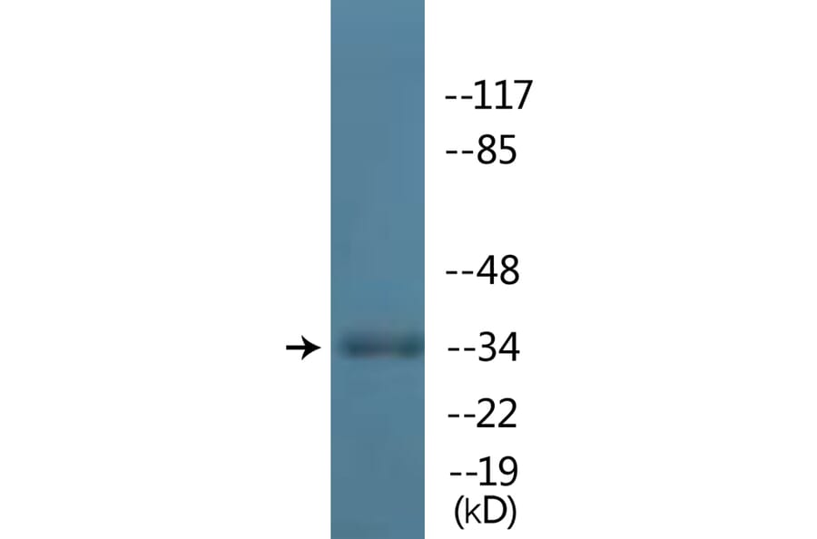 Western Blot - Anti-TAL-1 (phospho Ser122) Antibody (P12-1186) - Antibodies.com