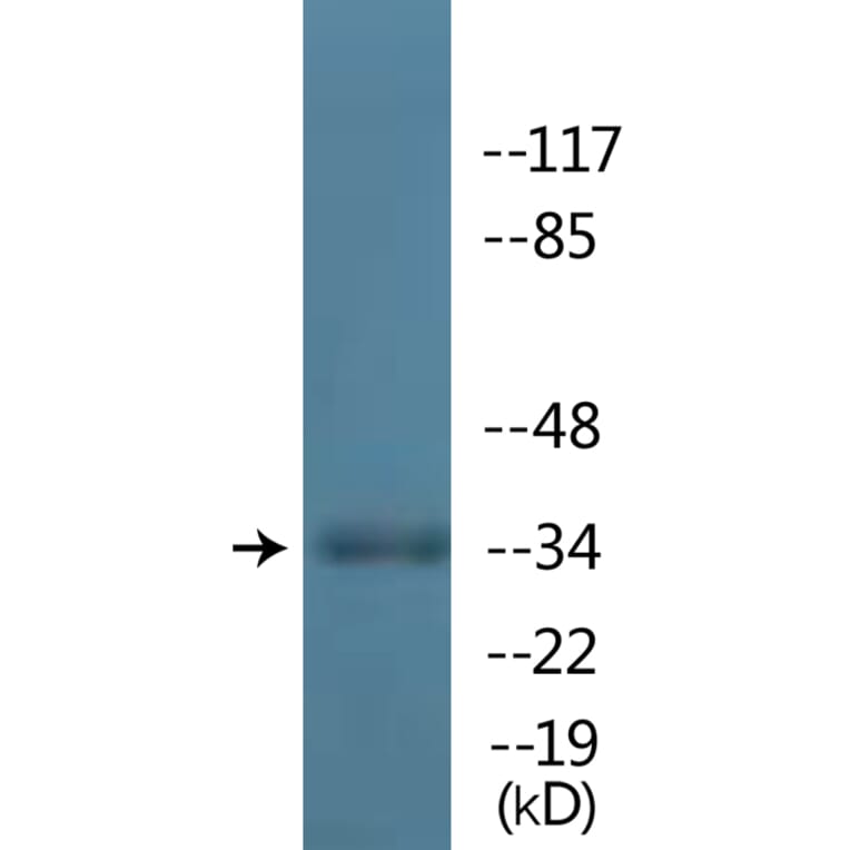 Western Blot - Anti-TAL-1 (phospho Ser122) Antibody (P12-1186) - Antibodies.com