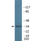 Western Blot - Anti-TAL-1 (phospho Ser122) Antibody (P12-1186) - Antibodies.com