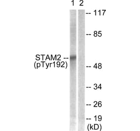 Western Blot - Anti-STAM2 (phospho Tyr192) Antibody (A1237) - Antibodies.com