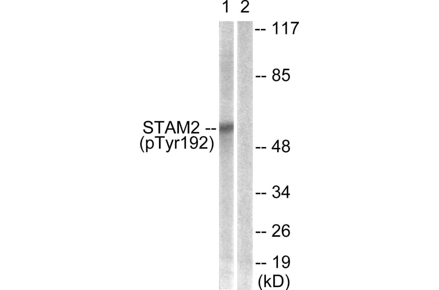 Western Blot - Anti-STAM2 (phospho Tyr192) Antibody (A1237) - Antibodies.com