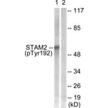 Western Blot - Anti-STAM2 (phospho Tyr192) Antibody (A1237) - Antibodies.com