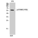 Western Blot - Anti-STAM2 (phospho Tyr192) Antibody (A1237) - Antibodies.com