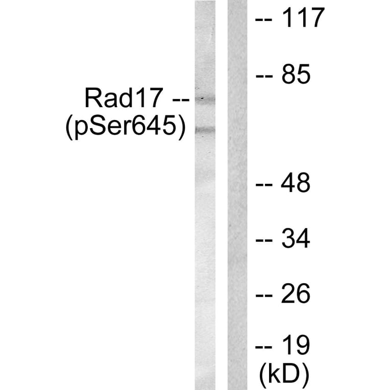 Western Blot - Anti-RAD17 (phospho Ser645) Antibody (A0085) - Antibodies.com
