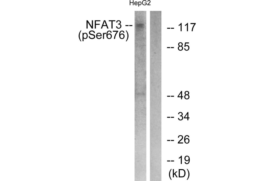 Western Blot - Anti-NFAT3 (phospho Ser676) Antibody (A0521) - Antibodies.com
