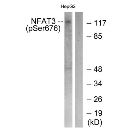 Western Blot - Anti-NFAT3 (phospho Ser676) Antibody (A0521) - Antibodies.com