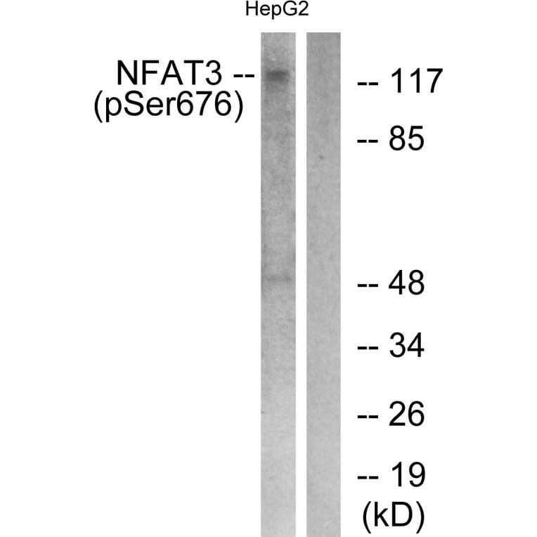 Western Blot - Anti-NFAT3 (phospho Ser676) Antibody (A0521) - Antibodies.com