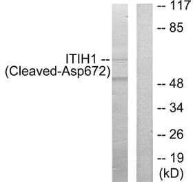 Western Blot - Anti-ITIH1 (cleaved Asp672) Antibody (L0299) - Antibodies.com