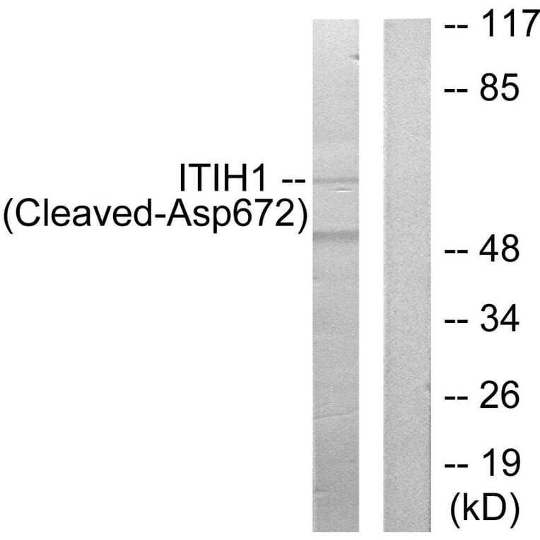 Western Blot - Anti-ITIH1 (cleaved Asp672) Antibody (L0299) - Antibodies.com