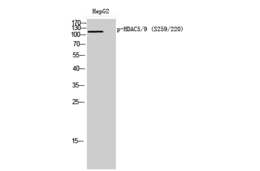 Western Blot - Anti-HDAC5 (phospho Ser259) Antibody (A0436) - Antibodies.com