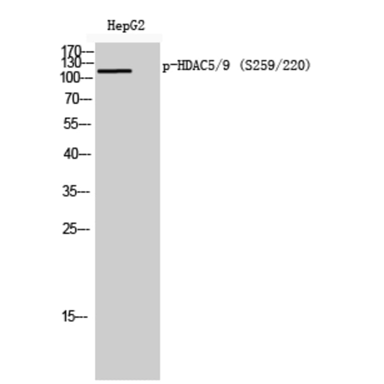 Western Blot - Anti-HDAC5 (phospho Ser259) Antibody (A0436) - Antibodies.com