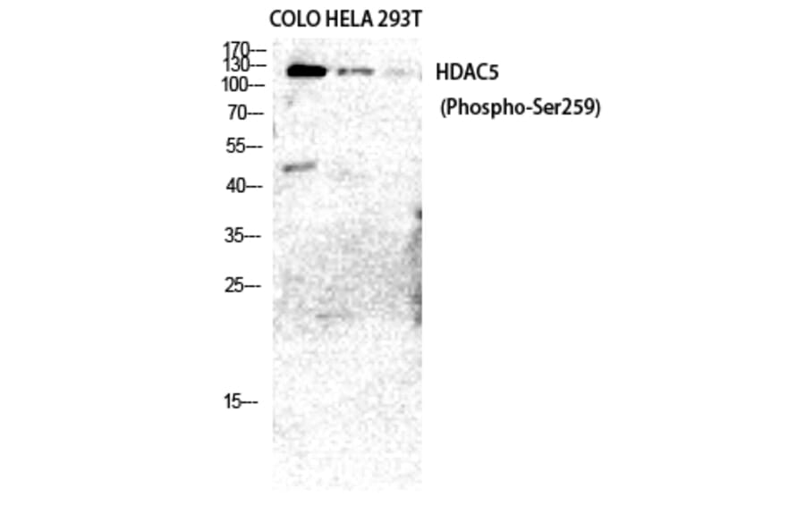 Western Blot - Anti-HDAC5 (phospho Ser259) Antibody (A0436) - Antibodies.com