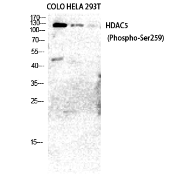 Western Blot - Anti-HDAC5 (phospho Ser259) Antibody (A0436) - Antibodies.com