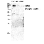 Western Blot - Anti-HDAC5 (phospho Ser259) Antibody (A0436) - Antibodies.com