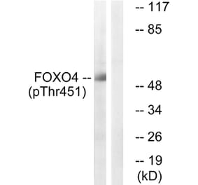 Western Blot - Anti-FOXO4 (phospho Thr451) Antibody (A1149) - Antibodies.com