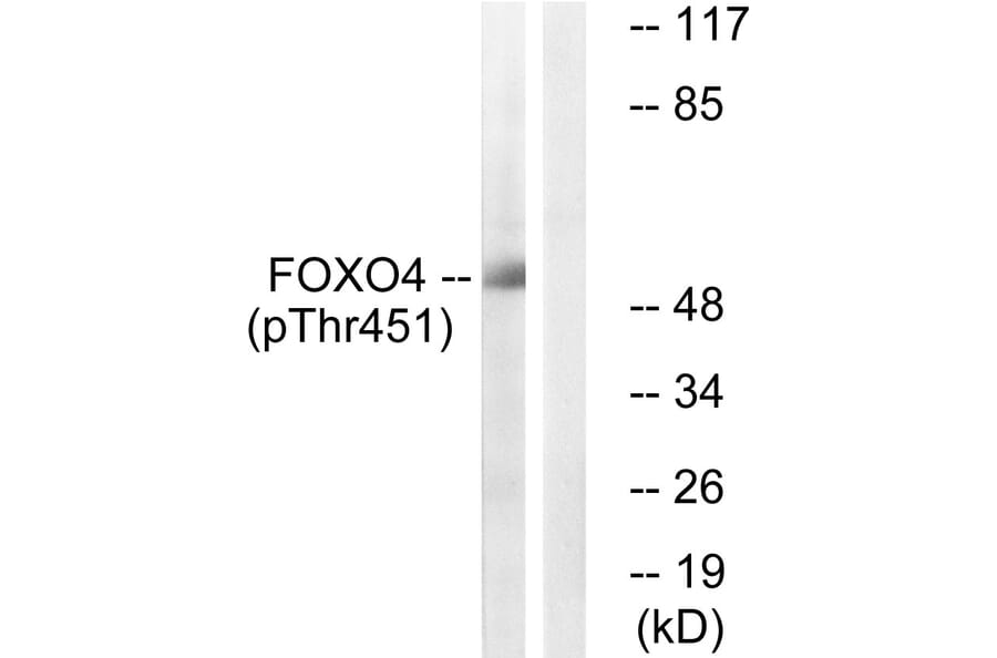 Western Blot - Anti-FOXO4 (phospho Thr451) Antibody (A1149) - Antibodies.com