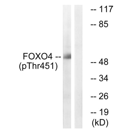 Western Blot - Anti-FOXO4 (phospho Thr451) Antibody (A1149) - Antibodies.com