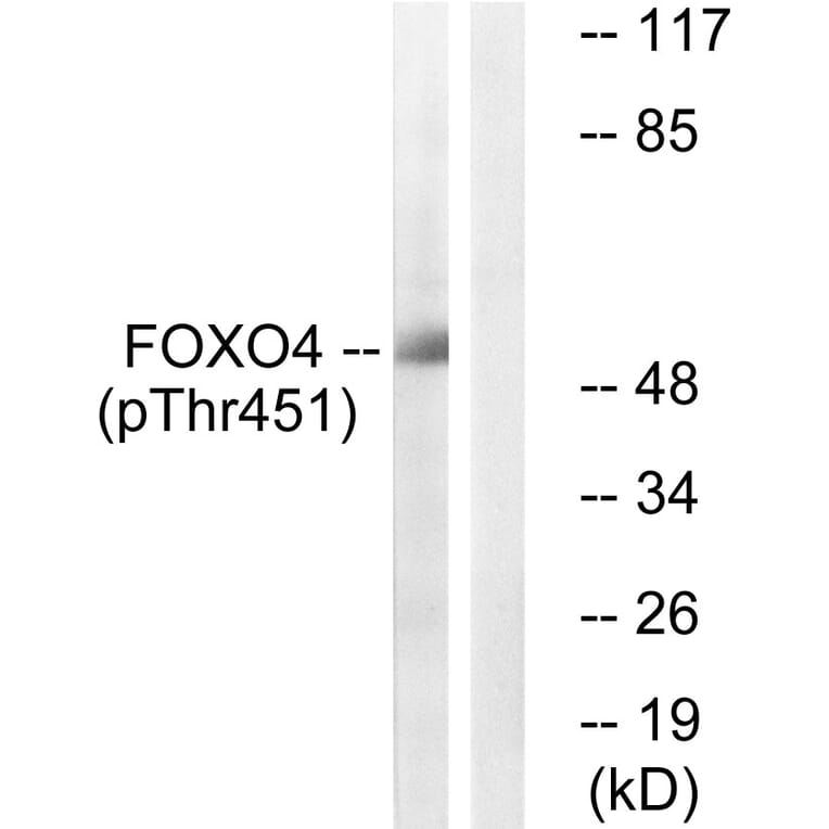 Western Blot - Anti-FOXO4 (phospho Thr451) Antibody (A1149) - Antibodies.com